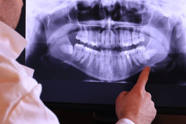 Best Emergency TMJ Treatment in Narberth, PA