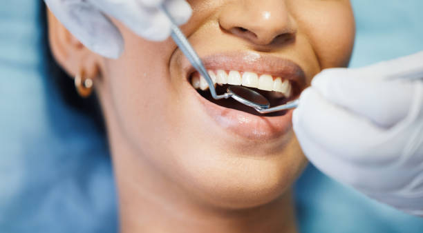 Best Emergency Treatment for Dental Infections or Abscesses in Narberth, PA